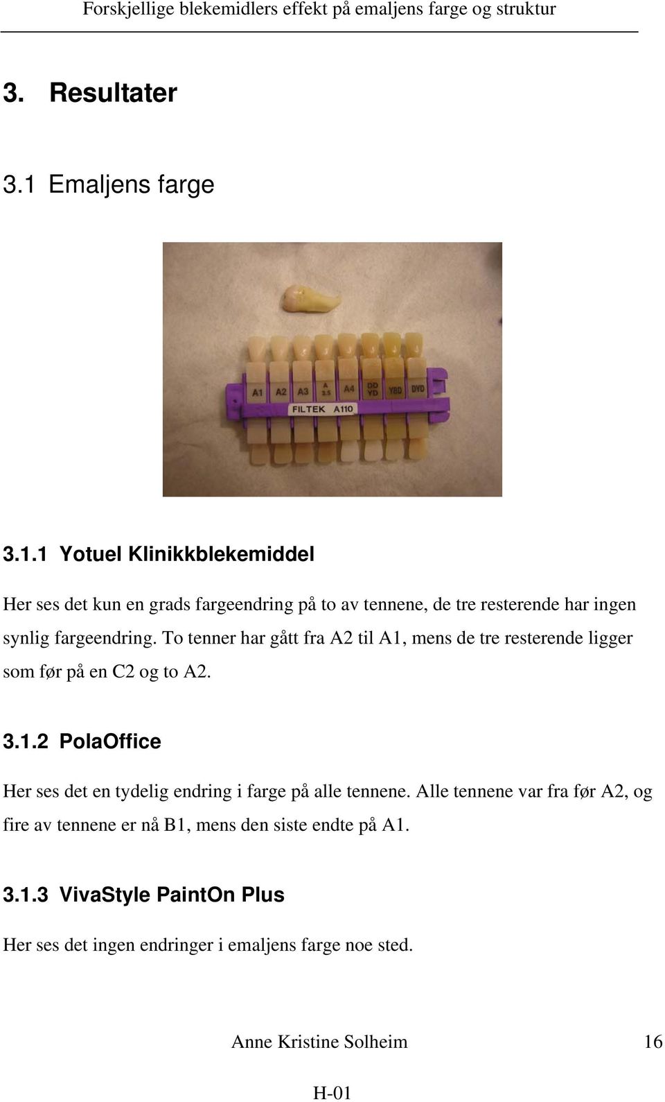 1 Yotuel Klinikkblekemiddel Her ses det kun en grads fargeendring på to av tennene, de tre resterende har ingen synlig