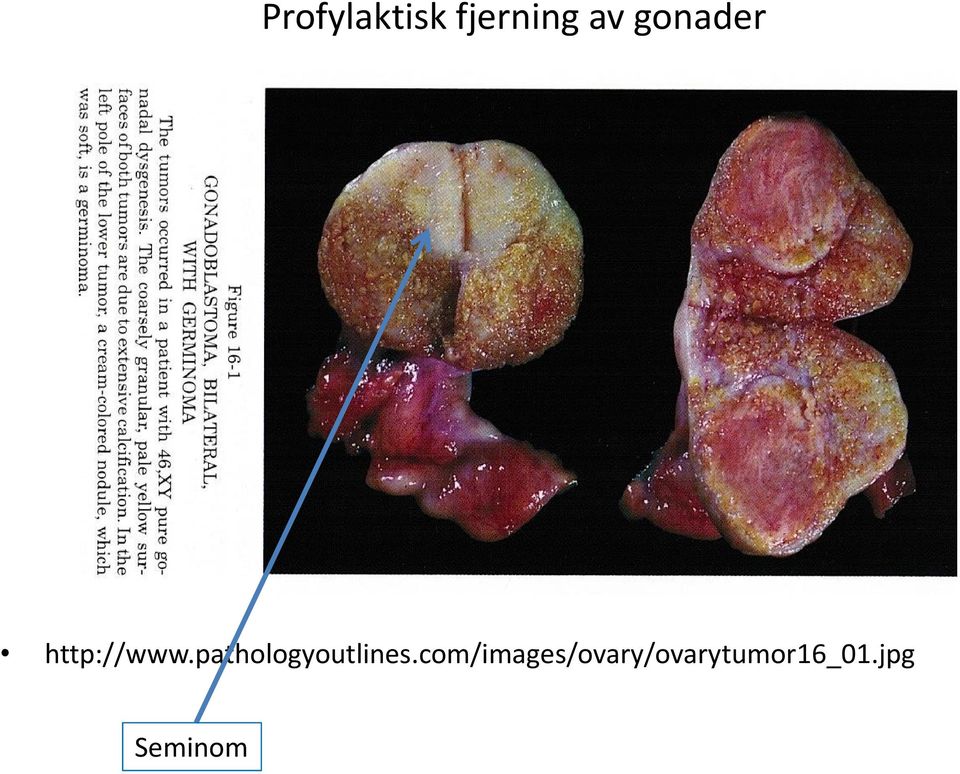 pathologyoutlines.