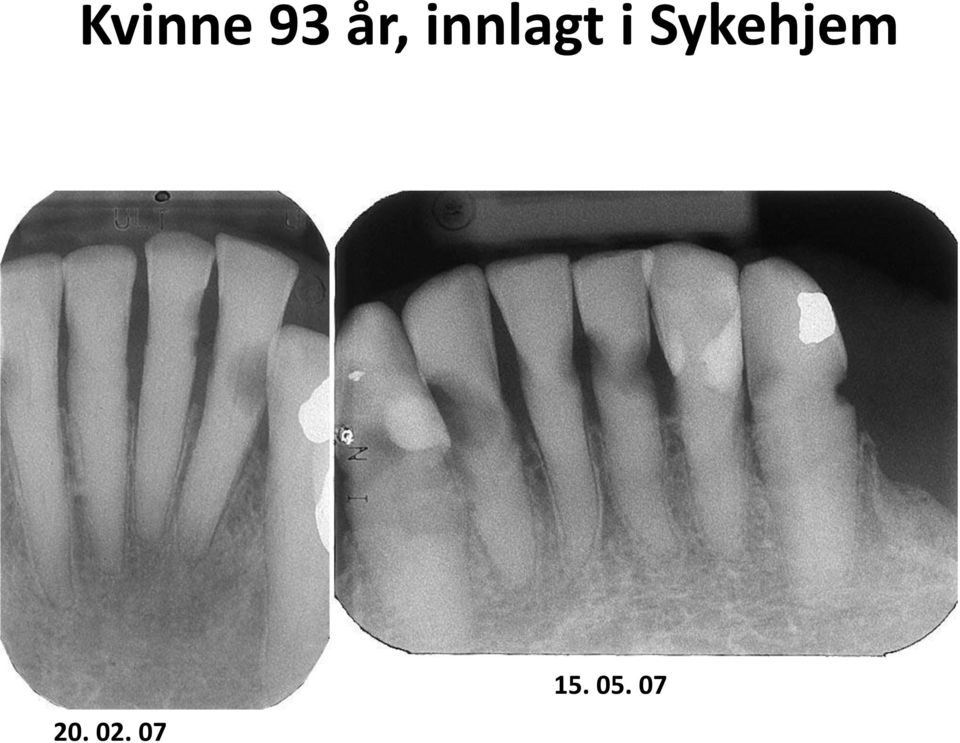 Sykehjem 20.