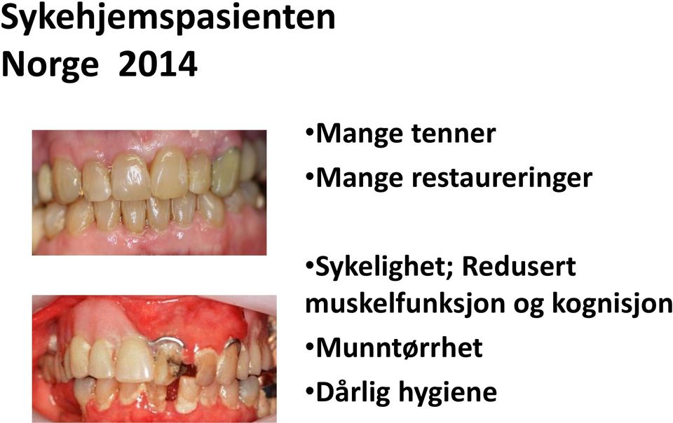 Sykelighet; Redusert