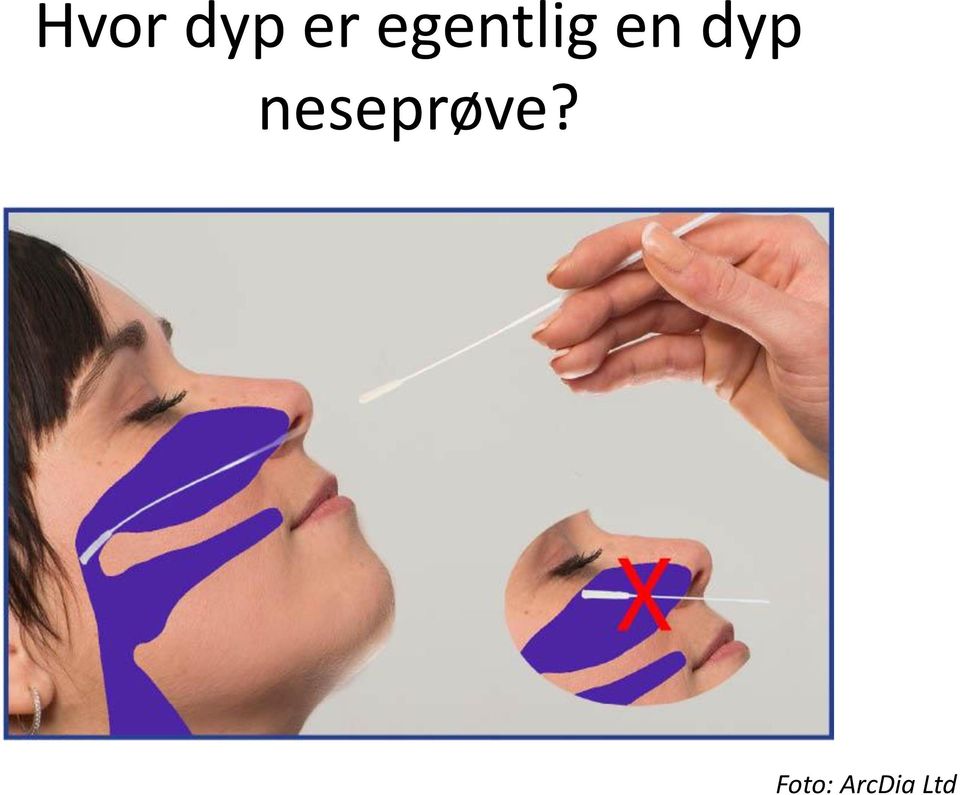 dyp neseprøve?