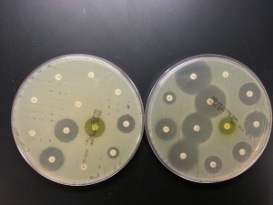 Pandemic E. coli B2-O25b-ST131 E.