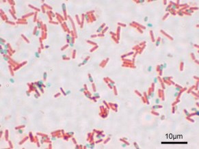 Klebsiella pneumonia Klonal