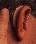 Høreapparat 1936