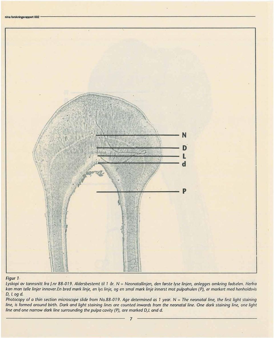 Photocopyof a thin sectionmicroscopeslidefrom No.88-019. Agedeterminedas 1 year. N = Theneonatalline, the firstlightstaining line, is formedaroundbirth.