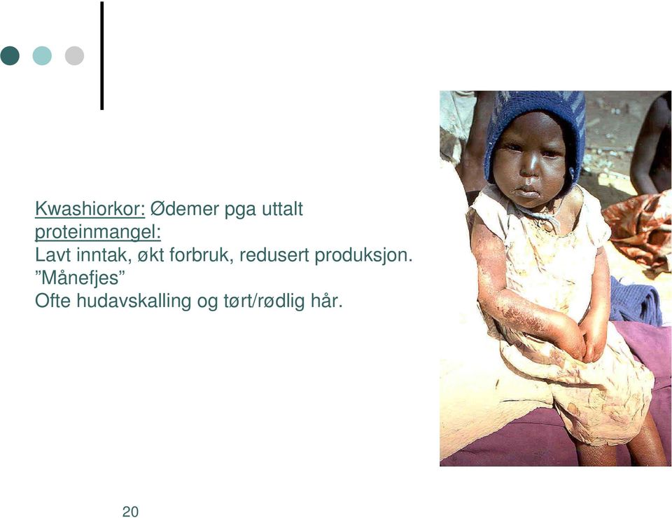 forbruk, redusert produksjon.