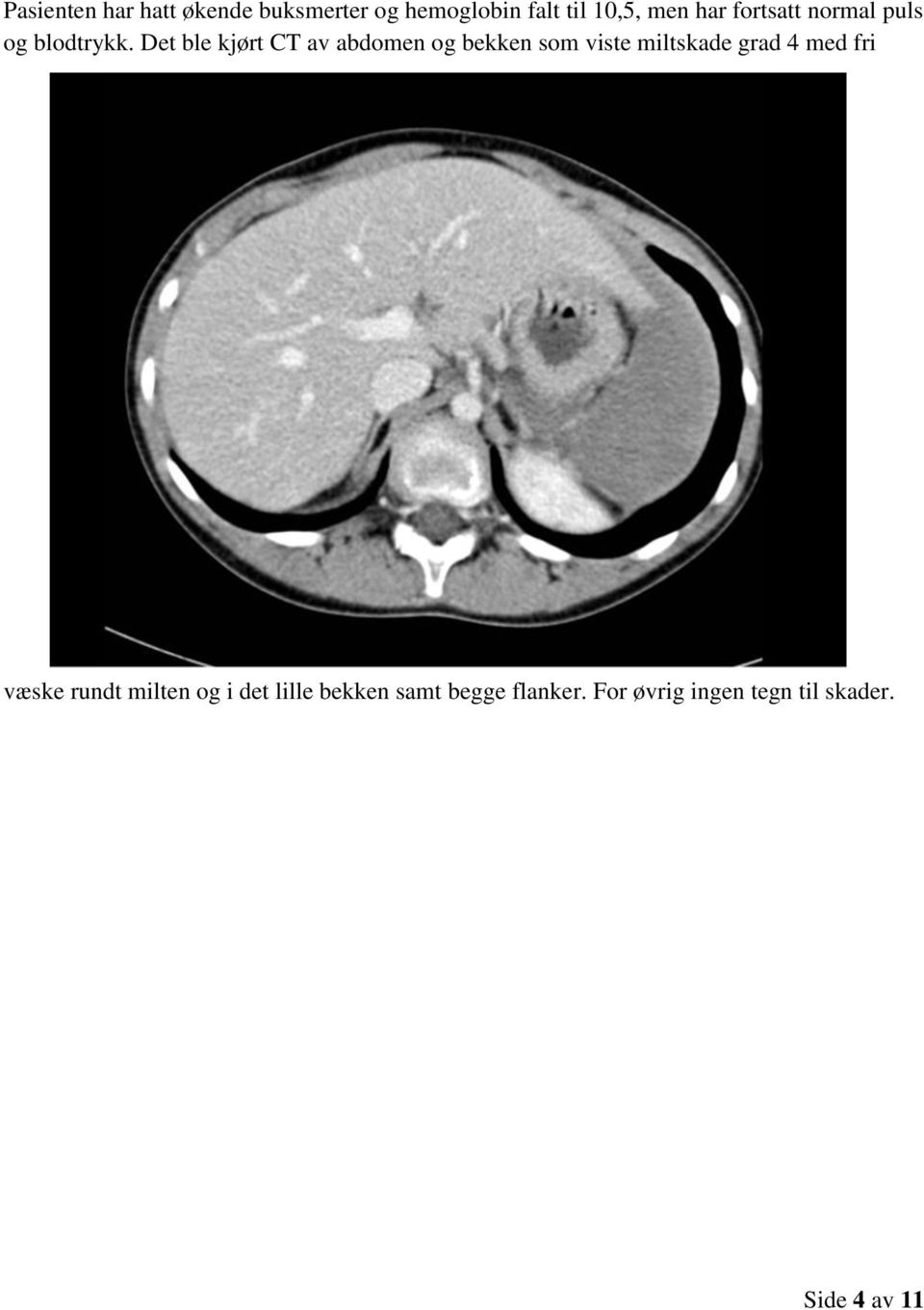 Det ble kjørt CT av abdomen og bekken som viste miltskade grad 4 med
