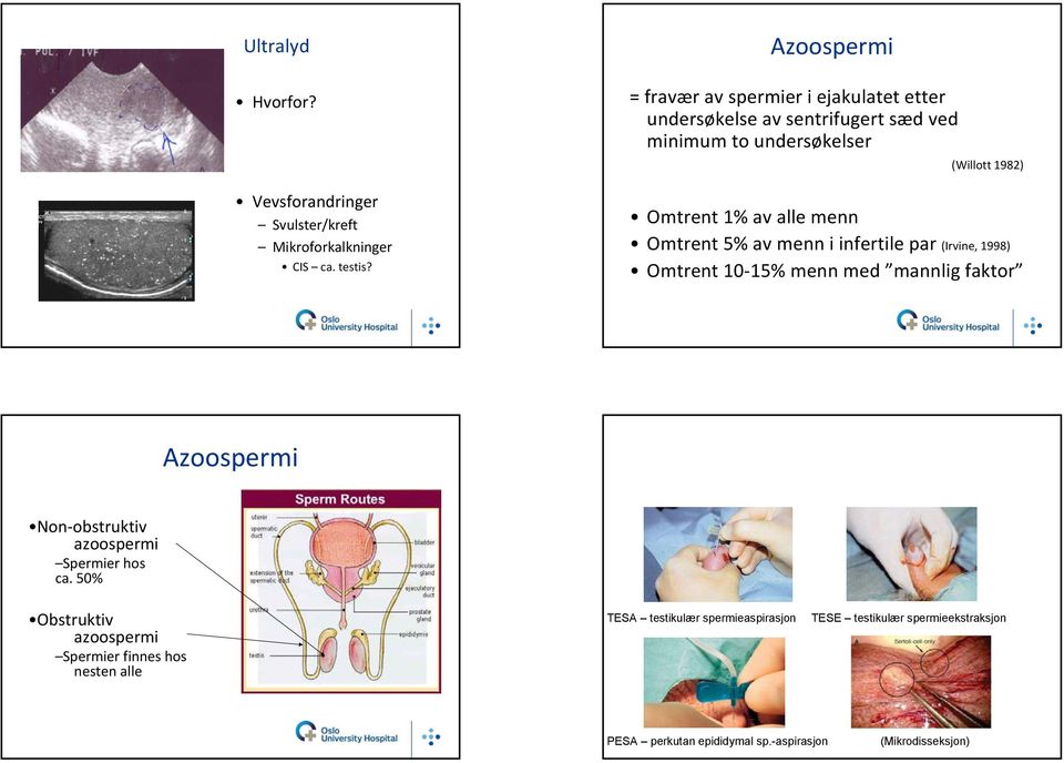 av alle menn Omtrent 5% av menn i infertile par (Irvine, 1998) Omtrent 10 15% menn med mannlig faktor Azoospermi Non obstruktiv azoospermi