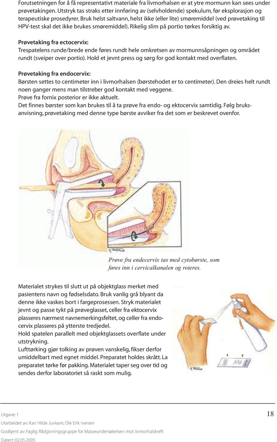 Bruk helst saltvann, helst ikke (eller lite) smøremiddel (ved prøvetaking til HPV-test skal det ikke brukes smøremiddel). Rikelig slim på portio tørkes forsiktig av.