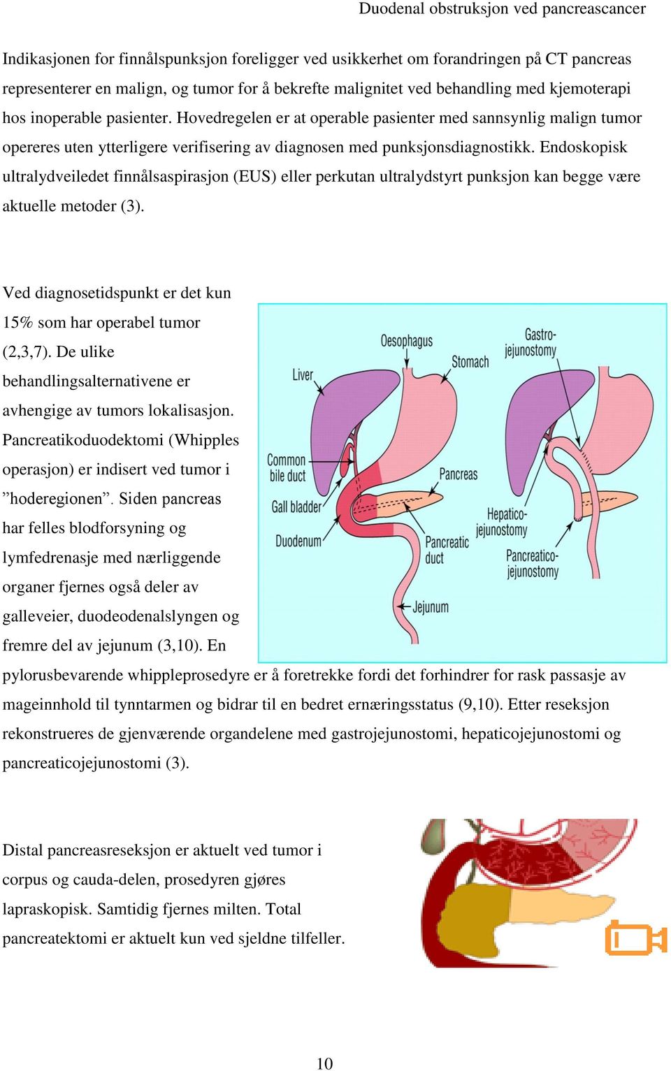 Endoskopisk ultralydveiledet finnålsaspirasjon (EUS) eller perkutan ultralydstyrt punksjon kan begge være aktuelle metoder (3). Ved diagnosetidspunkt er det kun 15% som har operabel tumor (2,3,7).