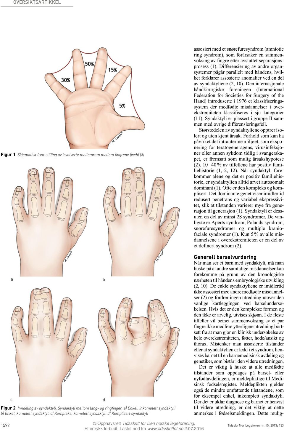 Den internasjonale håndkirurgiske foreningen (International Federation for Societies for Surgery of the Hand) introduserte i 1976 et klassifiseringssystem der medfødte misdannelser i