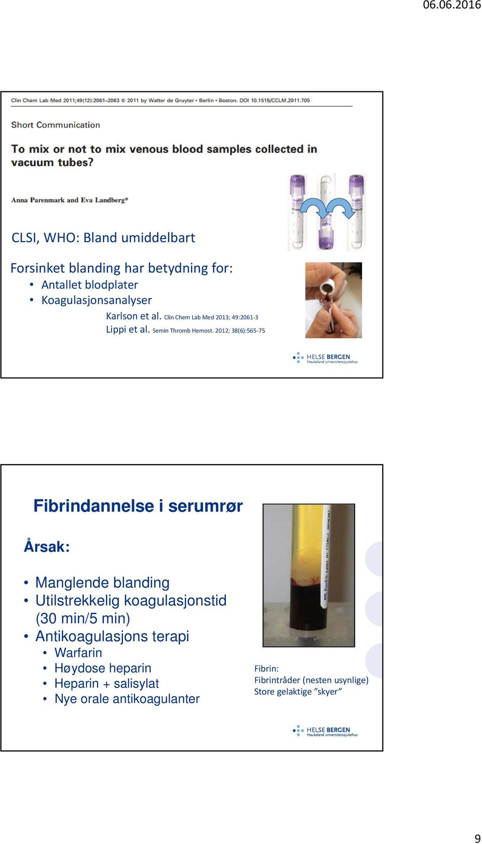 2012; 38(6):565 75 Fibrindannelse i serumrør Årsak: Manglende blanding Utilstrekkelig koagulasjonstid (30 min/5 min)