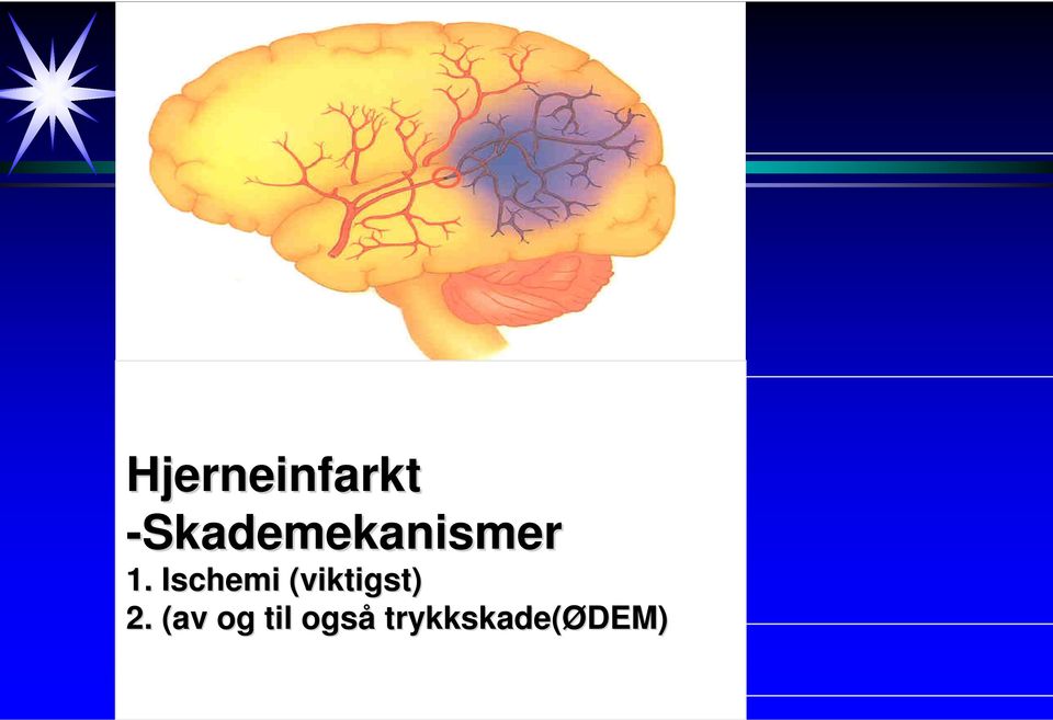 Ischemi (viktigst) 2.