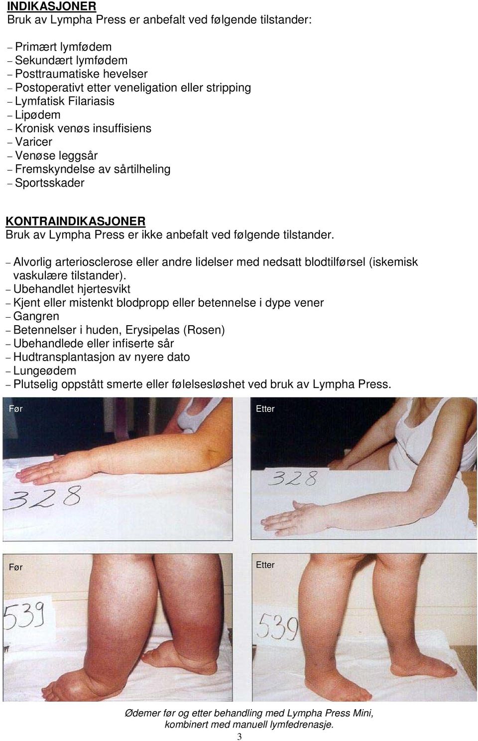 Alvorlig arteriosclerose eller andre lidelser med nedsatt blodtilførsel (iskemisk vaskulære tilstander).