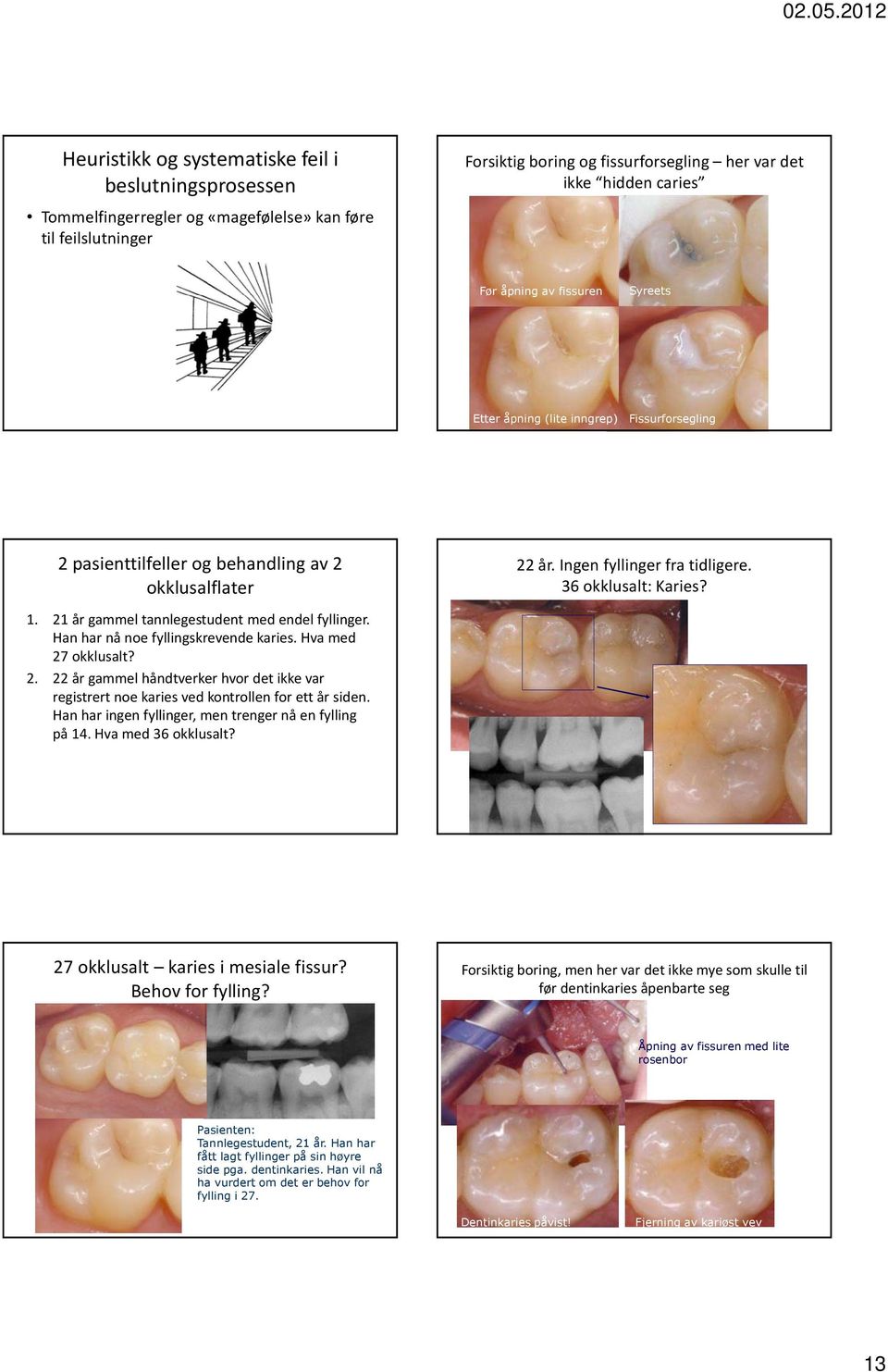 21 år gammel tannlegestudent med endel fyllinger. Han har nå noe fyllingskrevende karies. Hva med 27 okklusalt? 2. 22 år gammel håndtverker hvor det ikke var registrert noe karies ved kontrollen for ett år siden.