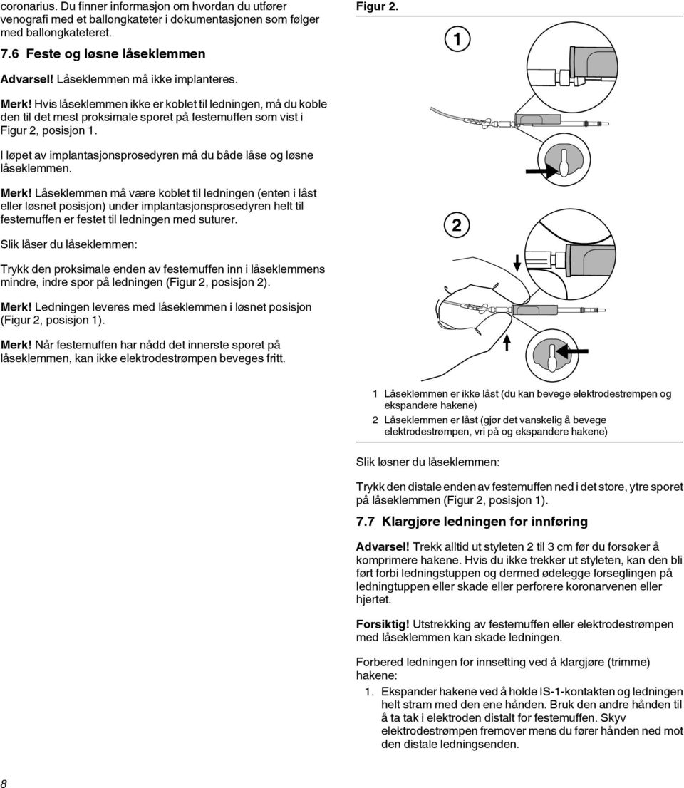 I løpet av implantasjonsprosedyren må du både låse og løsne låseklemmen. Merk!