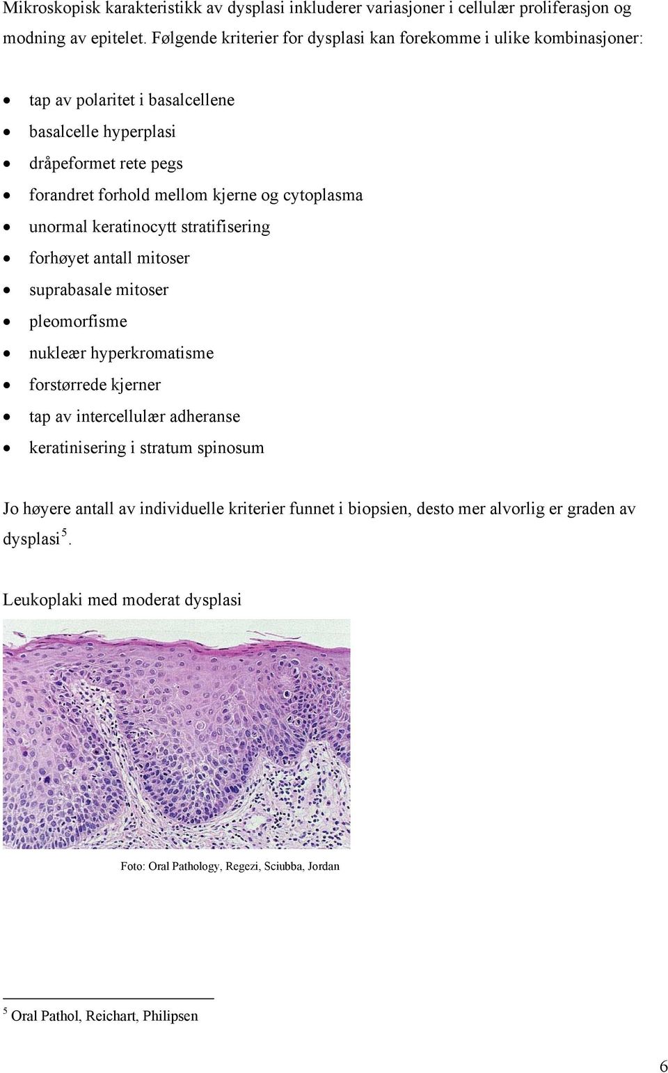 cytoplasma unormal keratinocytt stratifisering forhøyet antall mitoser suprabasale mitoser pleomorfisme nukleær hyperkromatisme forstørrede kjerner tap av intercellulær adheranse