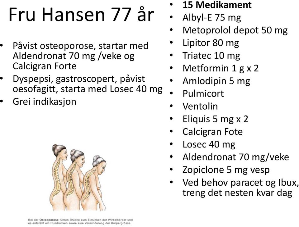 depot 50 mg Lipitor 80 mg Triatec 10 mg Metformin 1 g x 2 Amlodipin 5 mg Pulmicort Ventolin Eliquis 5 mg x 2