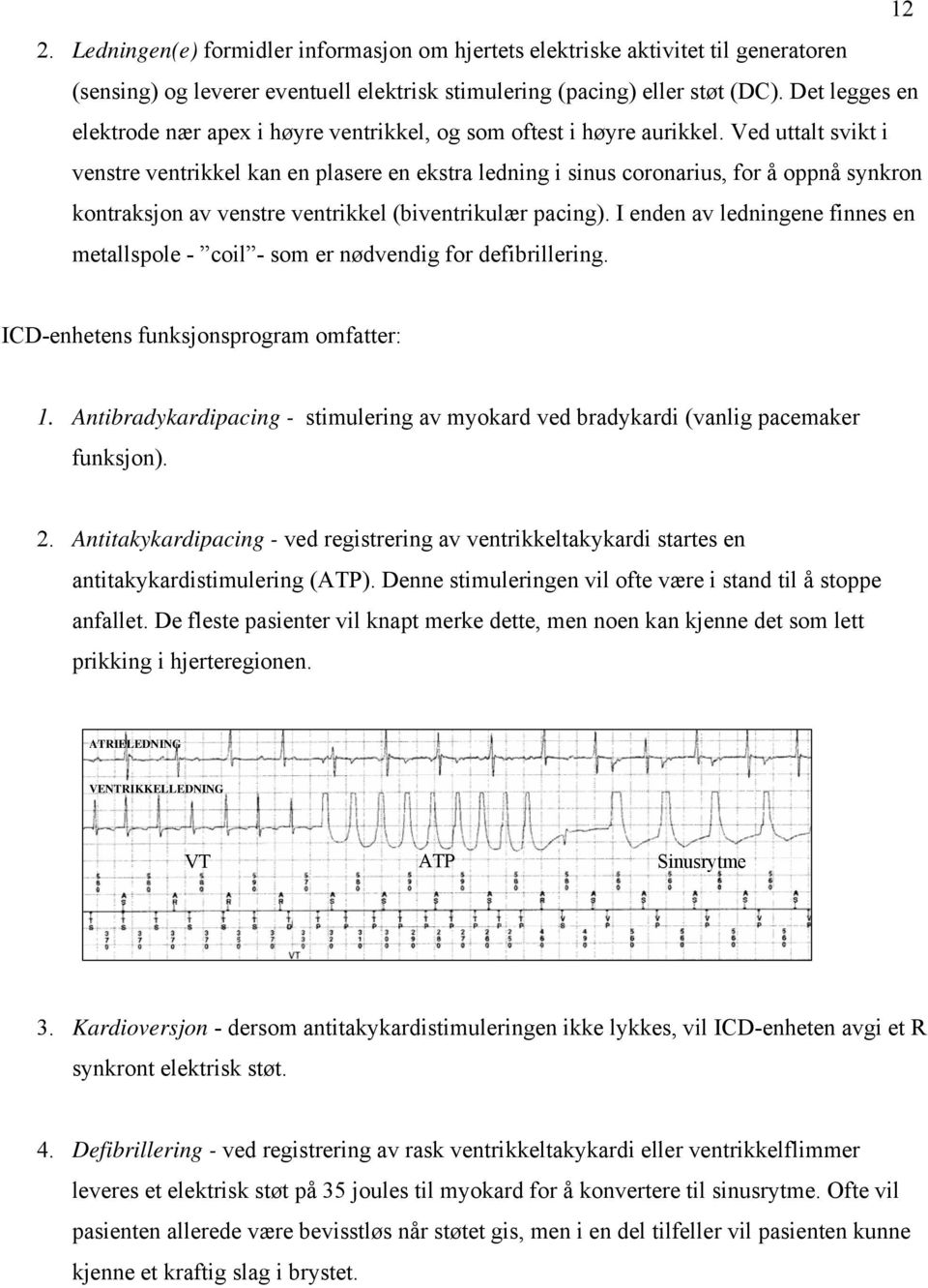 Ved uttalt svikt i venstre ventrikkel kan en plasere en ekstra ledning i sinus coronarius, for å oppnå synkron kontraksjon av venstre ventrikkel (biventrikulær pacing).