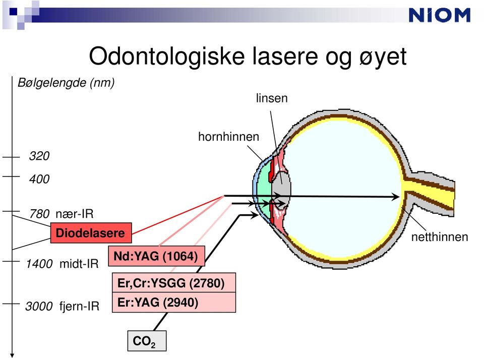 Diodelasere Nd:YAG (1064) 1400 midt-ir