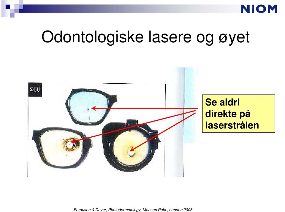 laserstrålen Ferguson & Dover,