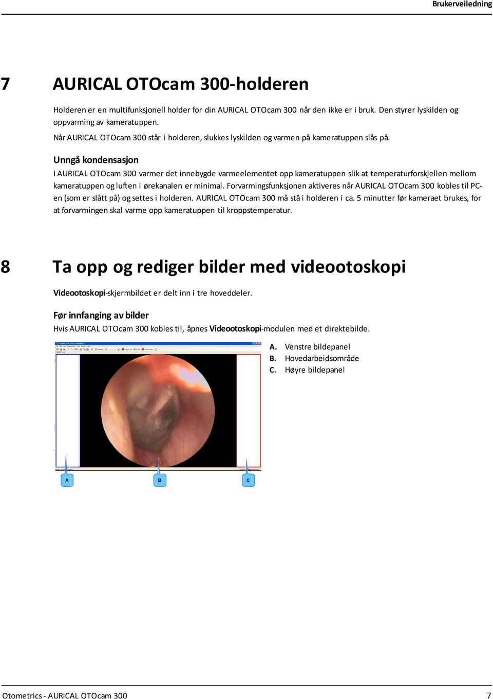 Unngå kondensasjon I AURICAL OTOcam 300 varmer det innebygde varmeelementet opp kameratuppen slik at temperaturforskjellen mellom kameratuppen og luften i ørekanalen er minimal.