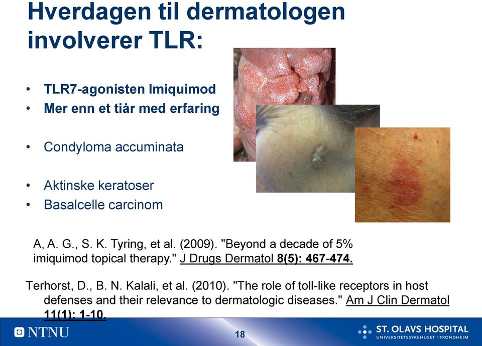 "Beyond a decade of 5% imiquimod topical therapy." J Drugs Dermatol 8(5): 467-474. Terhorst, D., B. N.
