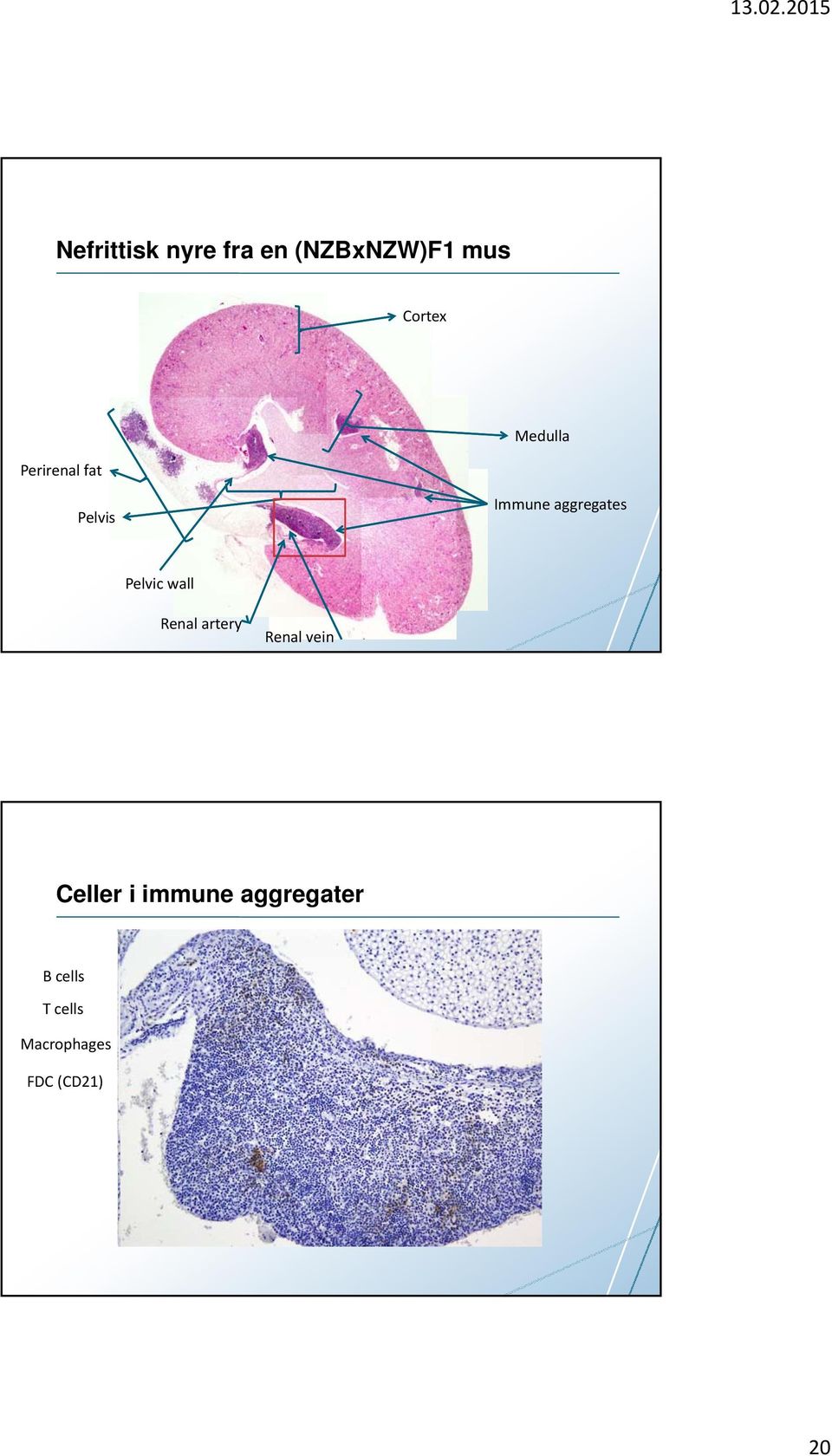 Pelvic wall Renal artery Renal vein Celler i