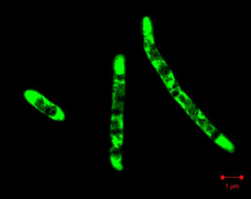 DNLF kurs Diakonhjemmet November 12 2015 Tuberkulose