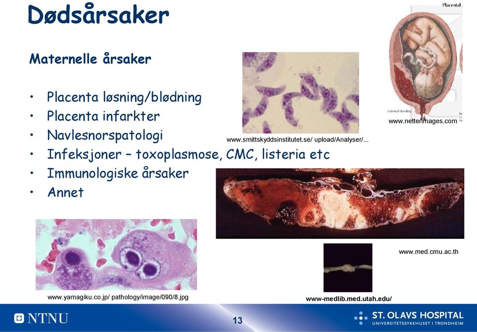 .. Infeksjoner toxoplasmose, CMC, listeria etc Immunologiske årsaker Annet www.