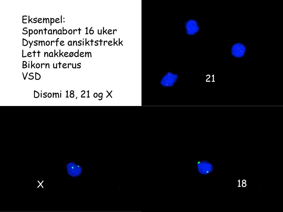 Lett nakkeødem Bikorn uterus