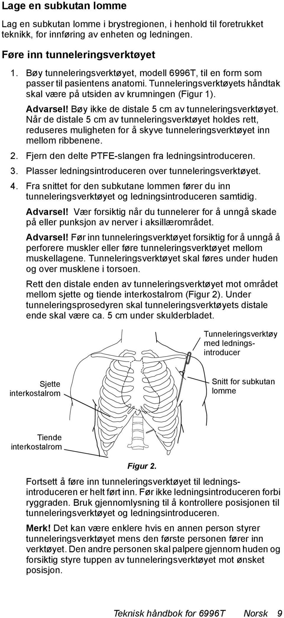 Bøy ikke de distale 5 cm av tunneleringsverktøyet. Når de distale 5 cm av tunneleringsverktøyet holdes rett, reduseres muligheten for å skyve tunneleringsverktøyet inn mellom ribbenene. 2.