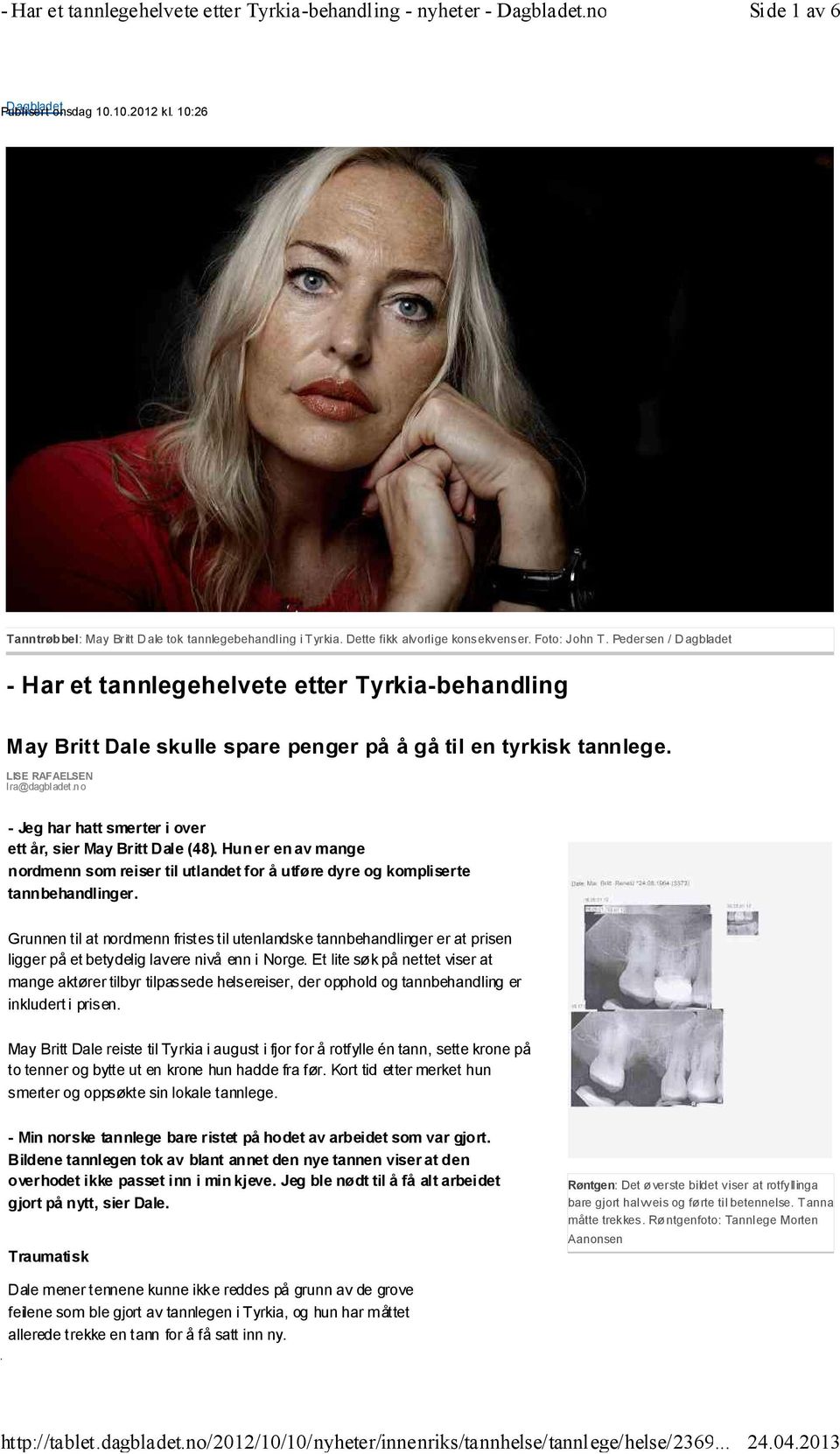 no - Jeg har hatt smerter i over ett år, sier May Britt Dale (48). Hun er en av mange nordmenn som reiser til utlandet for å utføre dyre og kompliserte tannbehandlinger.