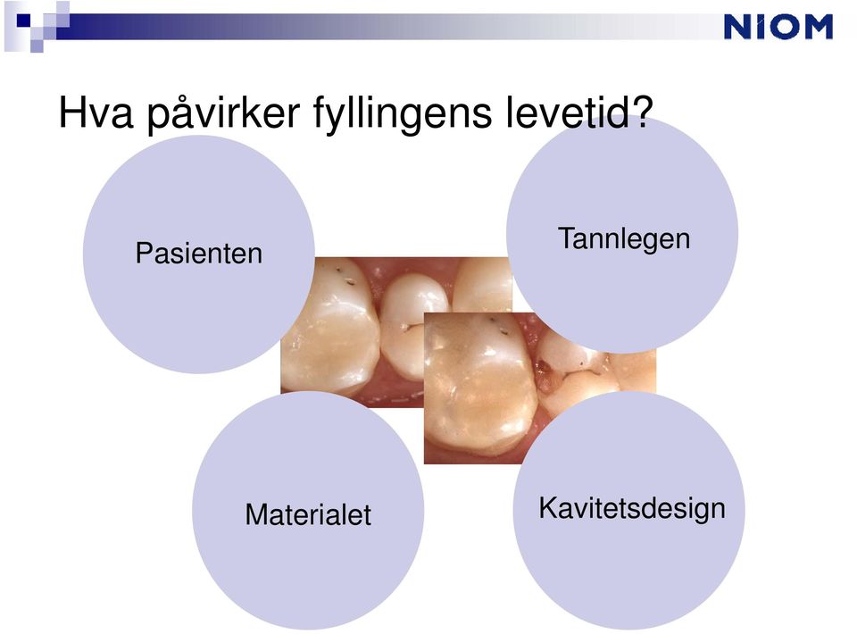 Pasienten Tannlegen