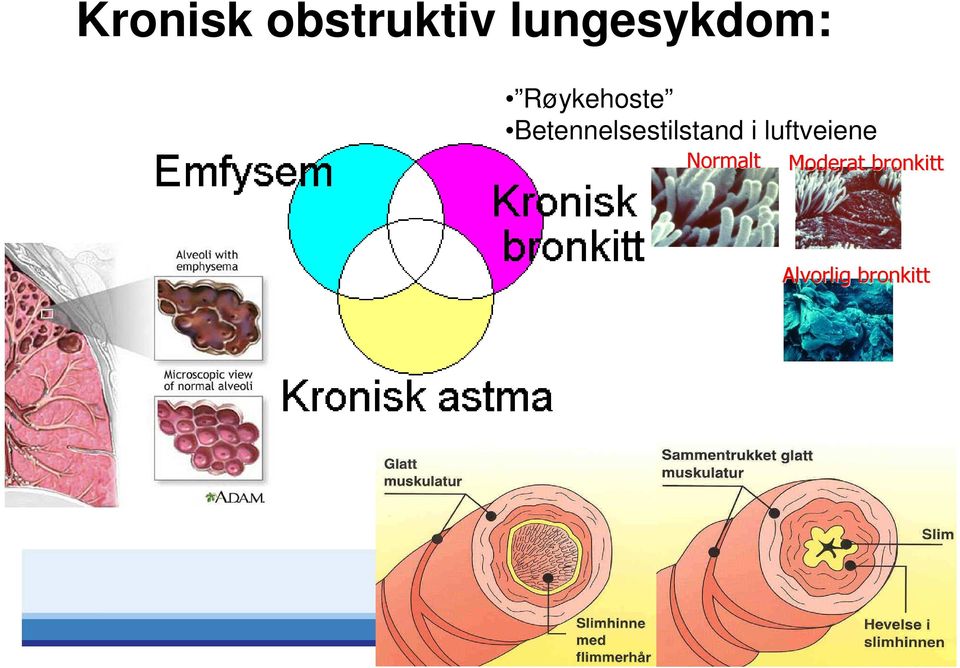 Betennelsestilstand i