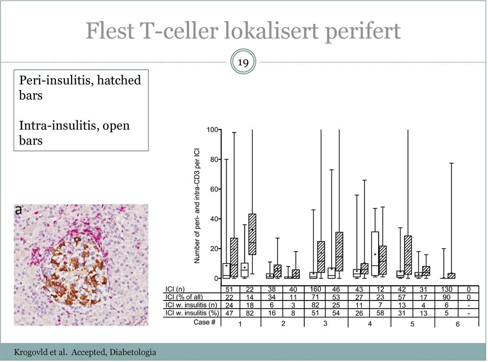 bars 19 Intra-insulitis, open