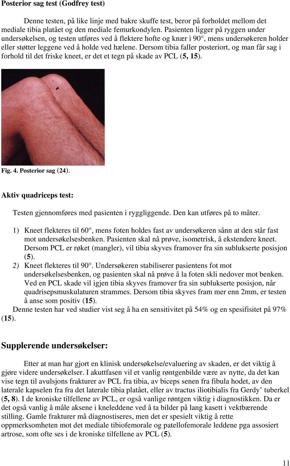 Dersom tibia faller posteriort, og man får sag i forhold til det friske kneet, er det et tegn på skade av PCL (5, 15). Fig. 4. Posterior sag (24).