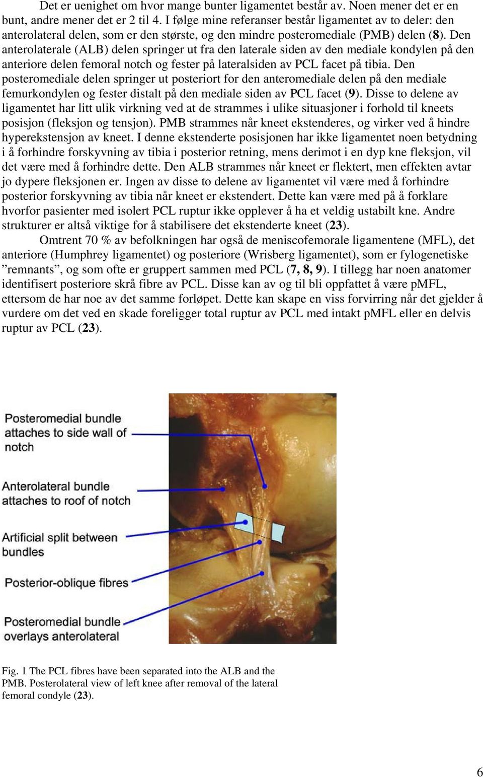 Den anterolaterale (ALB) delen springer ut fra den laterale siden av den mediale kondylen på den anteriore delen femoral notch og fester på lateralsiden av PCL facet på tibia.