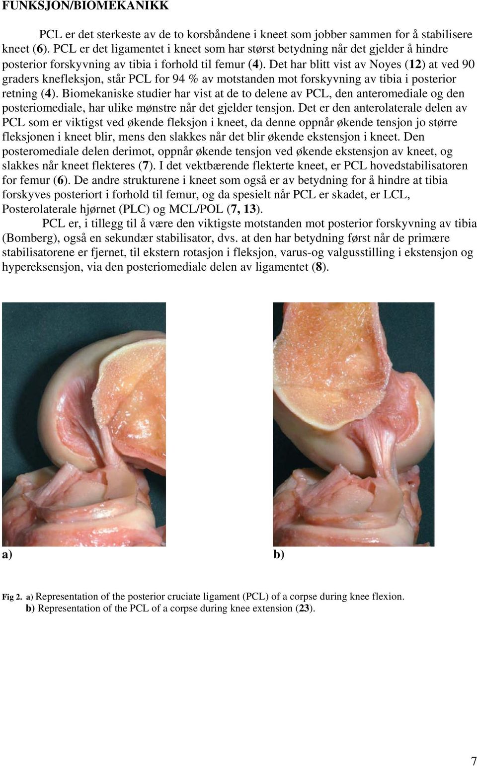 Det har blitt vist av Noyes (12) at ved 90 graders knefleksjon, står PCL for 94 % av motstanden mot forskyvning av tibia i posterior retning (4).