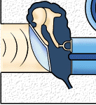 Basilar Membrane Deflections In Response To Low Frequency Sound From: