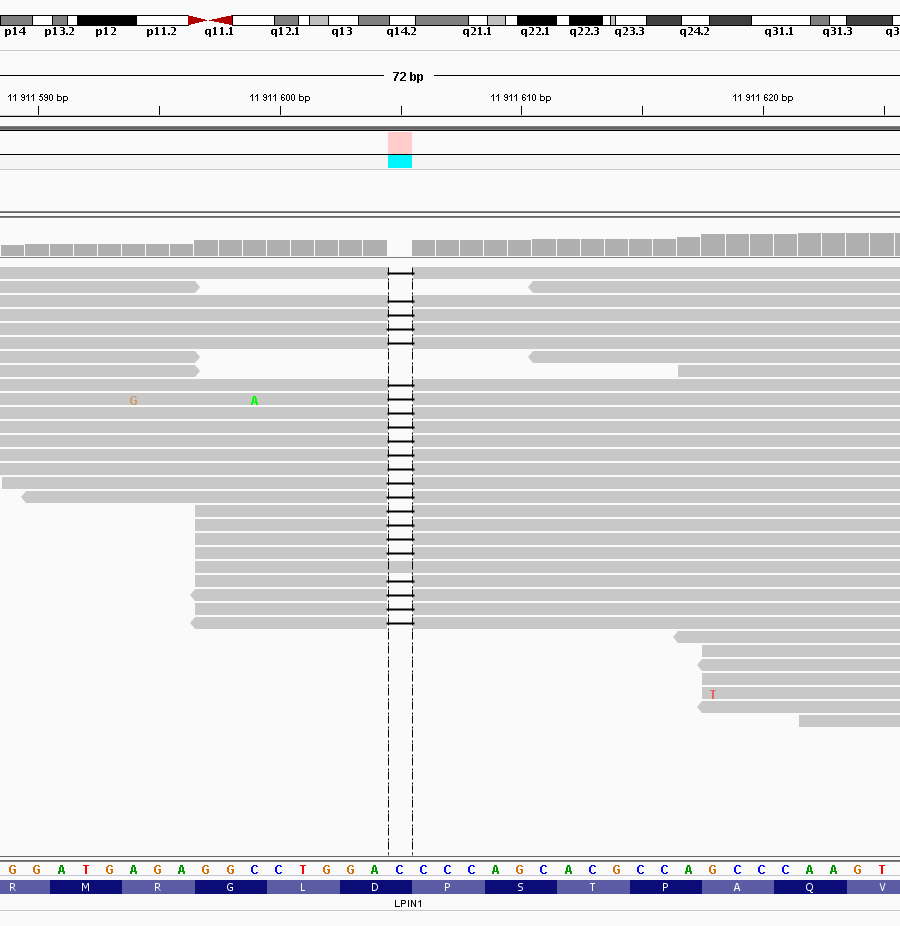 Resultater II- for restriktiv filtrering Pasient f.