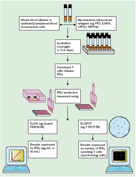 IGRA: Interferon gamma release assays T SPOT-TB (ELISPOT) Måler antall IFN-γ