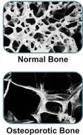 muscle strength in the lower extremities.