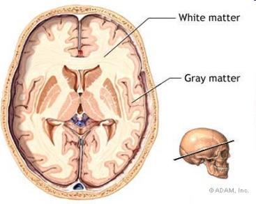 atferdsendringer Epilepsi (blandingstyper) Cerebellum/ Lillehjernen Ataxi Hypotoni Svake dype sene reflekser over tid