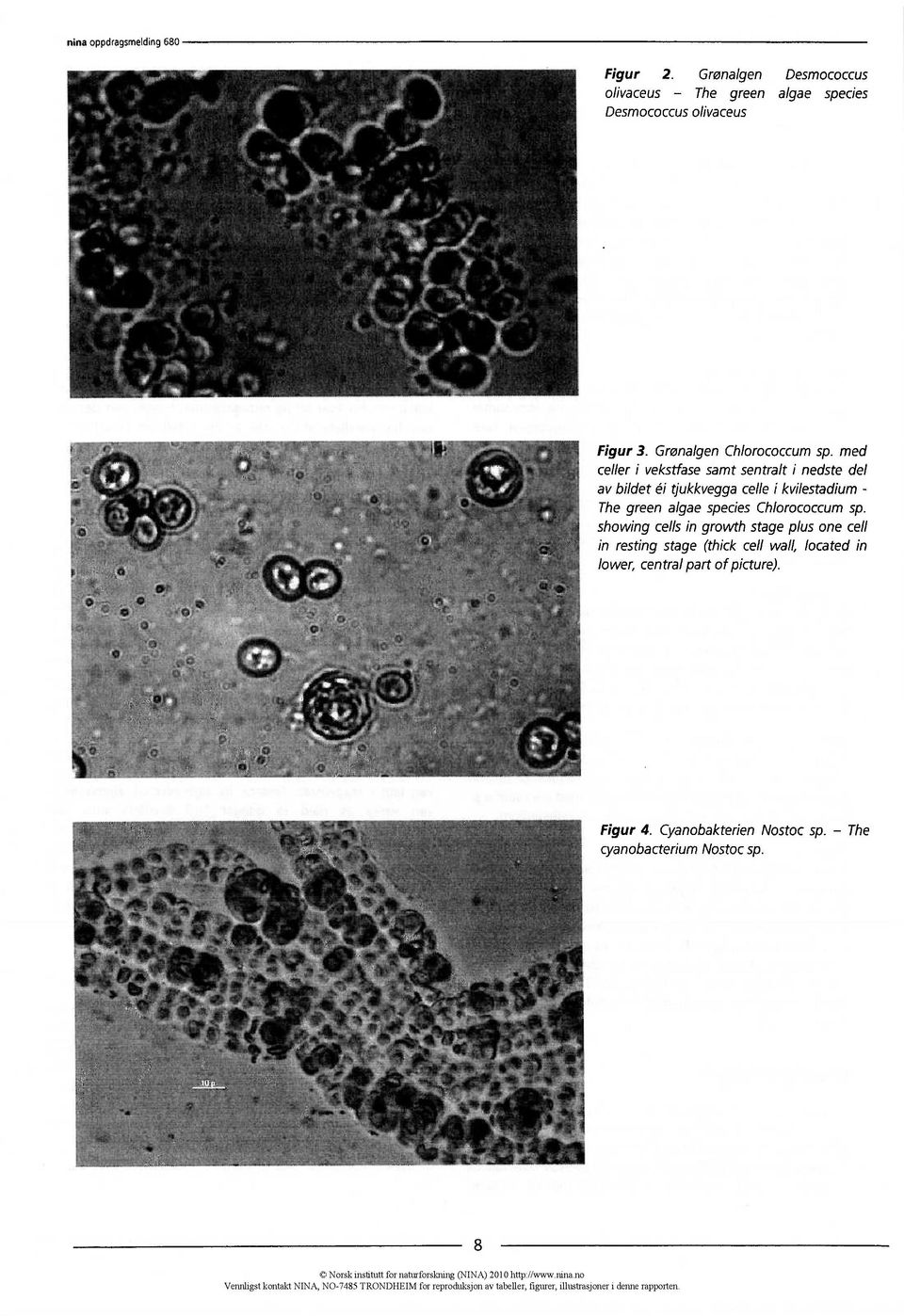 showing cells in growth stage plus one cell in resting stage (thick cell wall, located in lower, central part of picture). Figur 4. Cyanobakterien Nostoc sp.