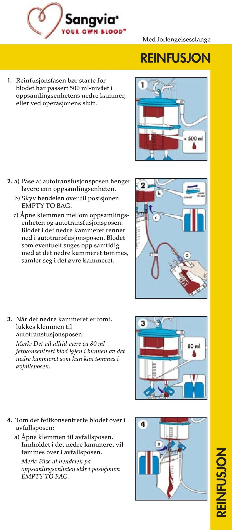 Blodet i det nedre kammeret renner ned i autotransfusjonsposen. Blodet som eventuelt suges opp samtidig med at det nedre kammeret tømmes, samler seg i det øvre kammeret. 3.