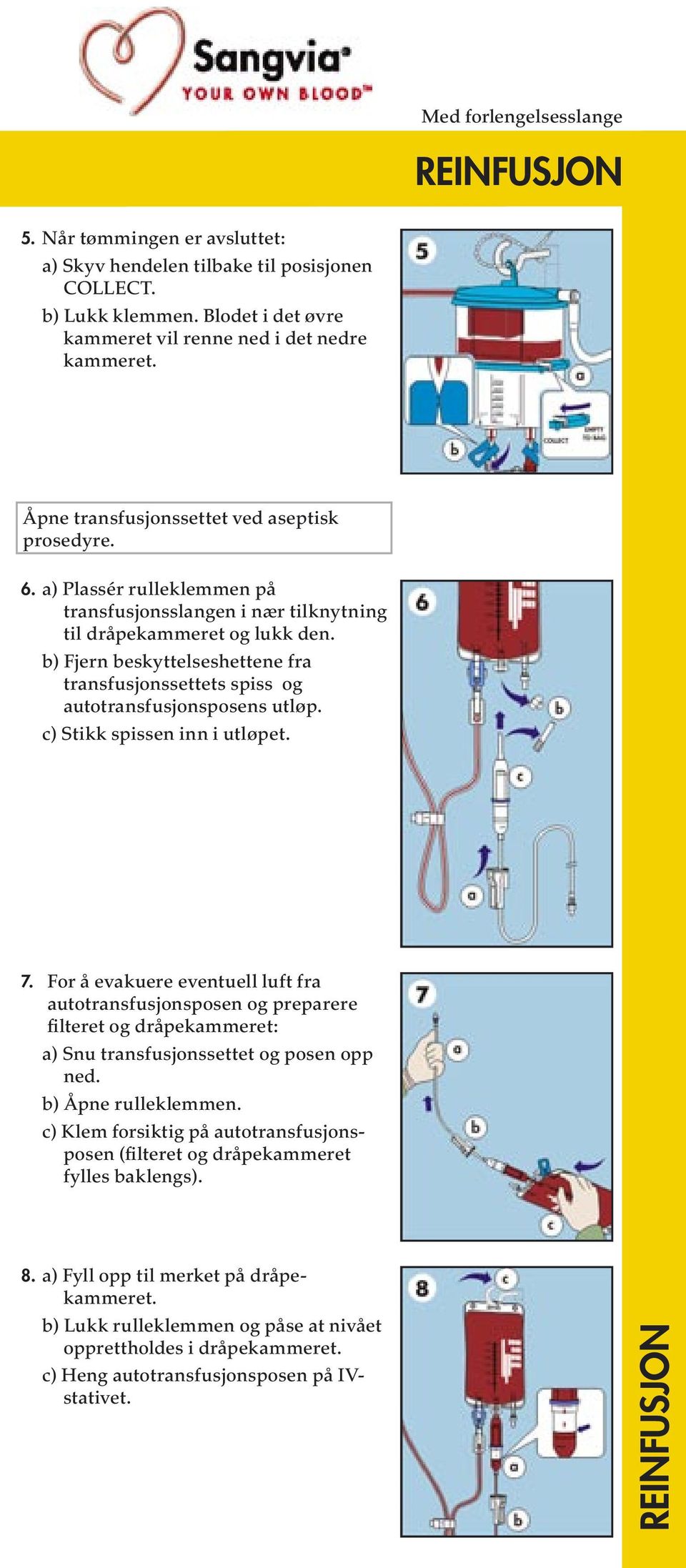 b) Fjern beskyttelseshettene fra transfusjonssettets spiss og autotransfusjonsposens utløp. c) Stikk spissen inn i utløpet. 7.