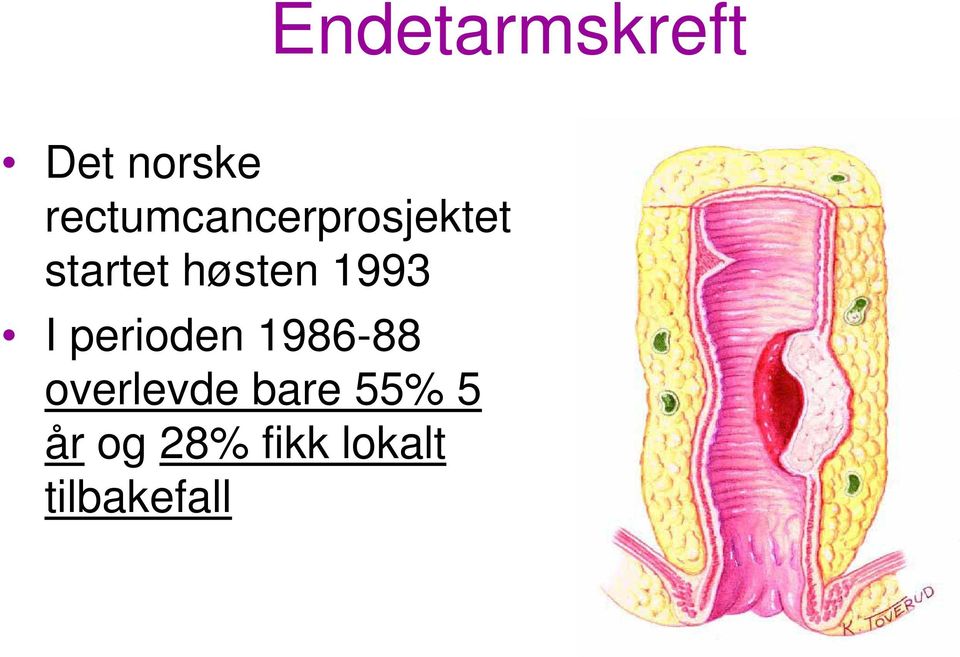 høsten 1993 I perioden 1986-88