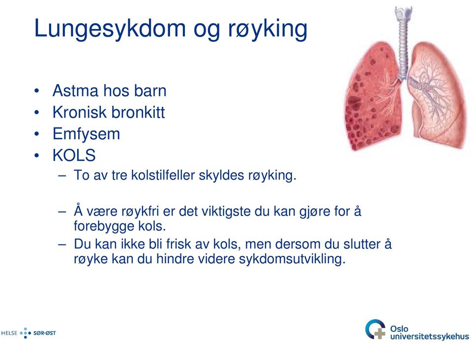 Å være røykfri er det viktigste du kan gjøre for å forebygge kols.