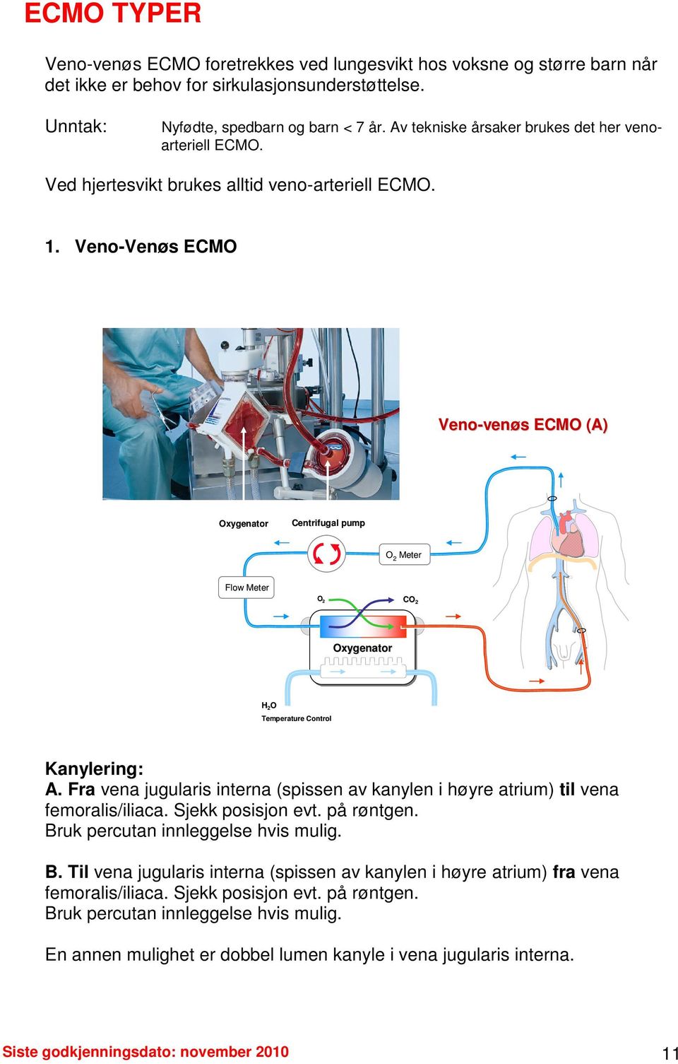 Veno-Venøs ECMO Veno-ven venøs ECMO (A) Oxygenator Centrifugal pump O Meter 2 Flow Meter O 2 CO 2 Oxygenator H 2 O Temperature Control Kanylering: A.